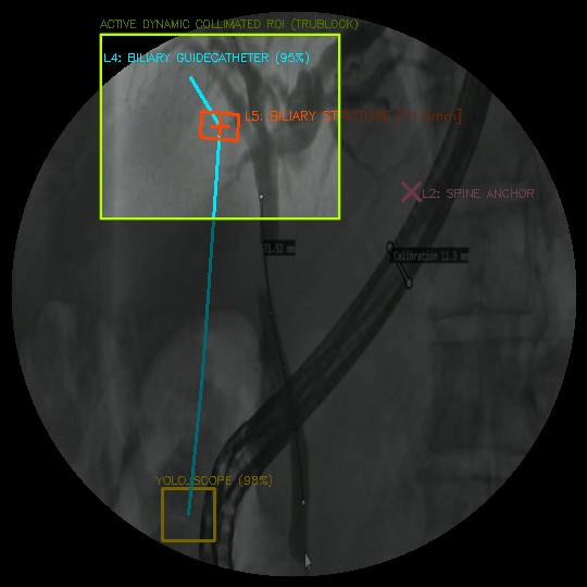 Clinical Clip 3 Surgical Suite Constraints